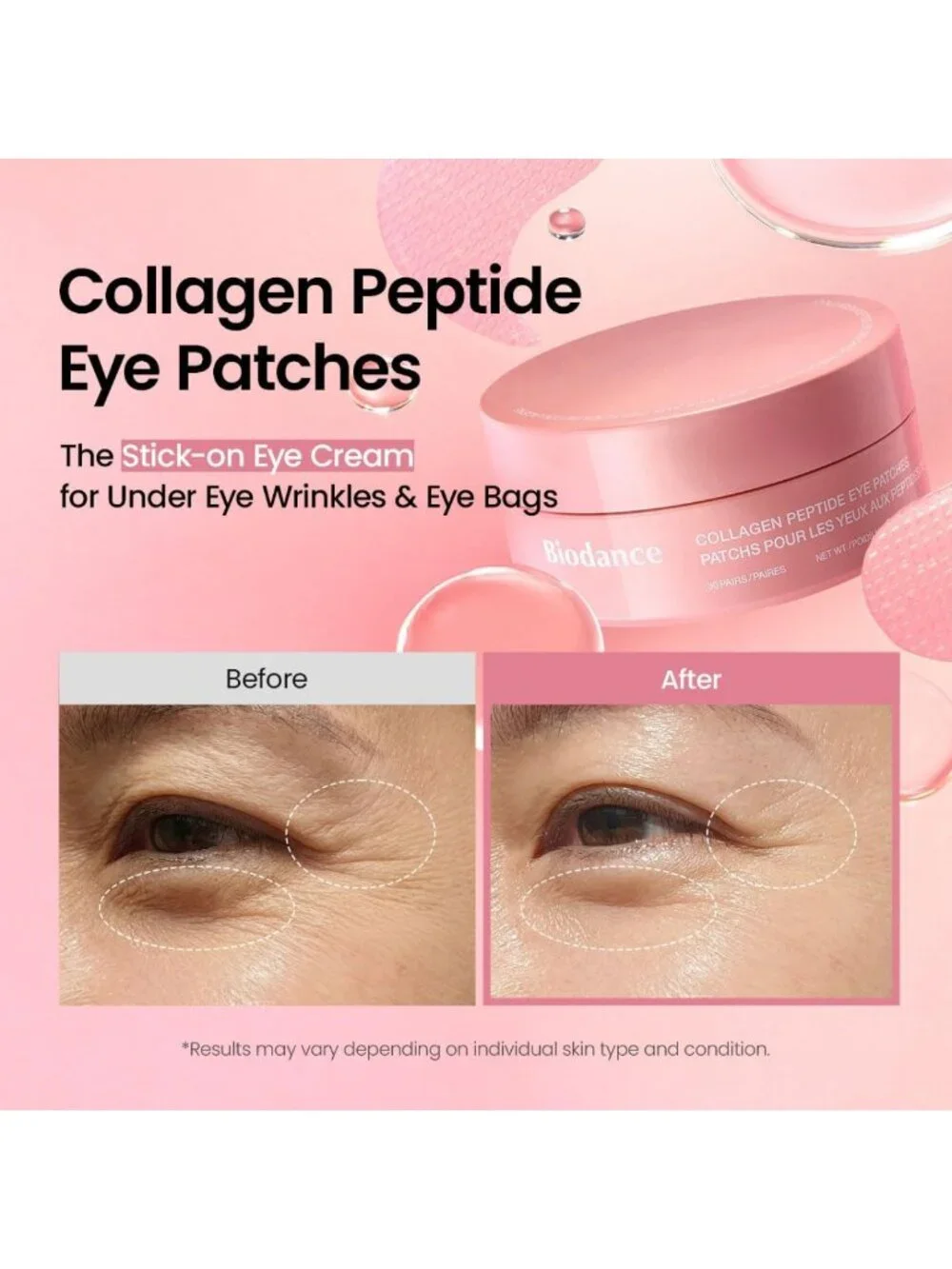 Hydrogel Eye Patches for Under Eyes - Collagen Peptide, Anti-Wrinkle, 60 Count